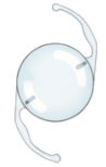 Illustration of a toric intraocular lens.